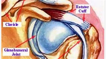 Swimming Shoulder Pain